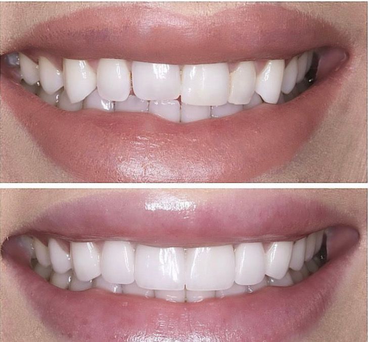 Victoria Eugenia Valderrama León-9