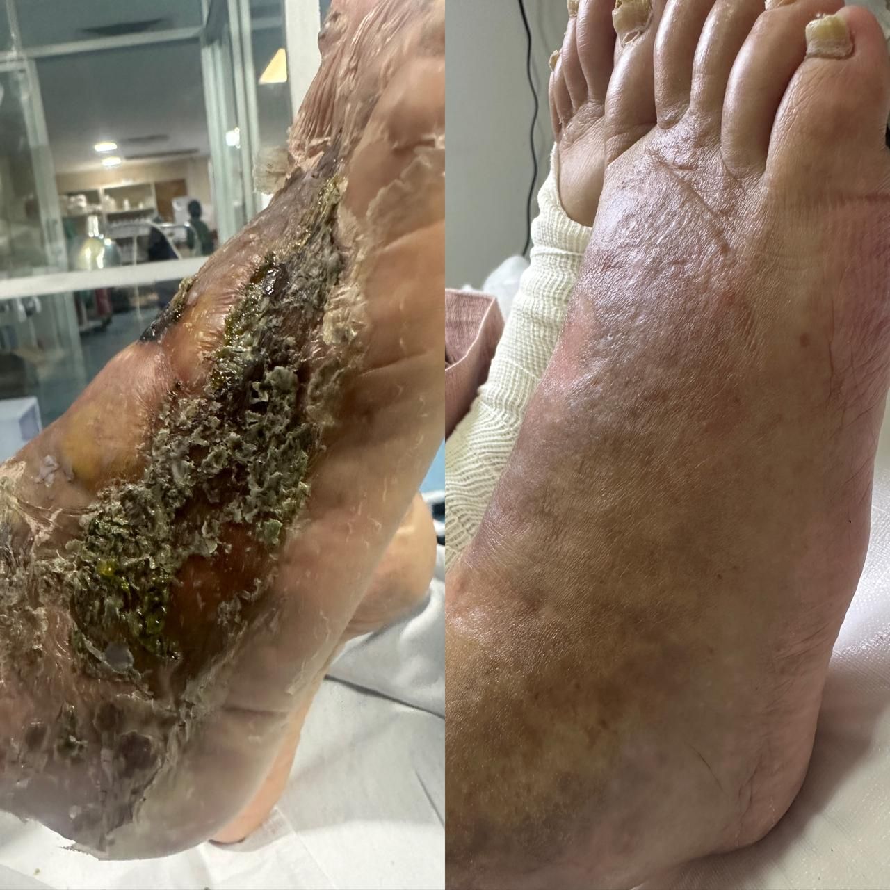 Jhonatan López González-65