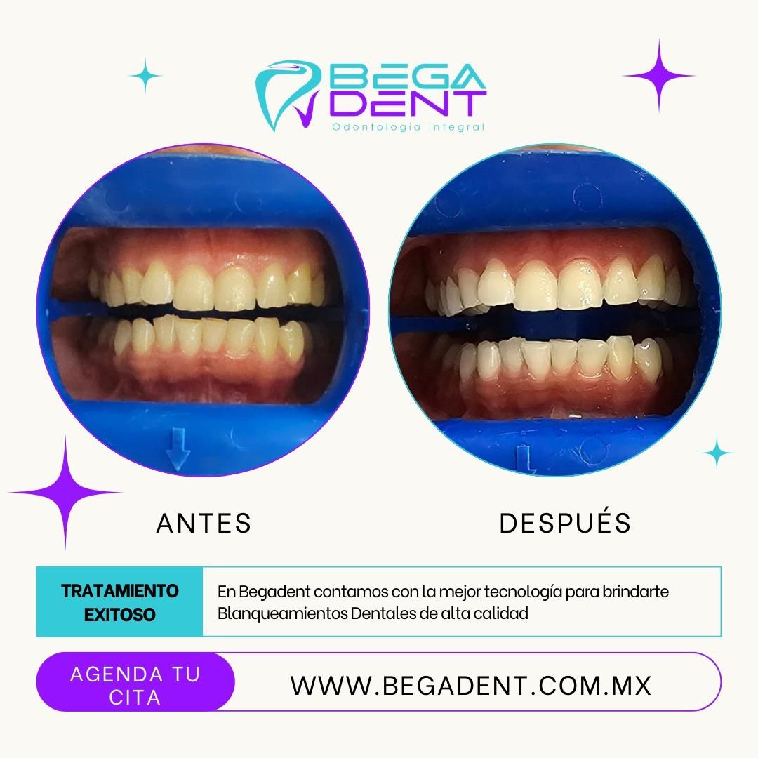 Laura Karla Becerra Gamiño-28