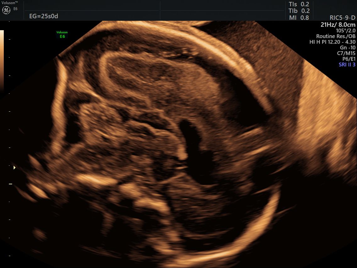 Guillermo Abrego Rodríguez-15