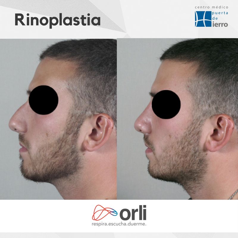 Jorge Armando Parra Mariscal-0