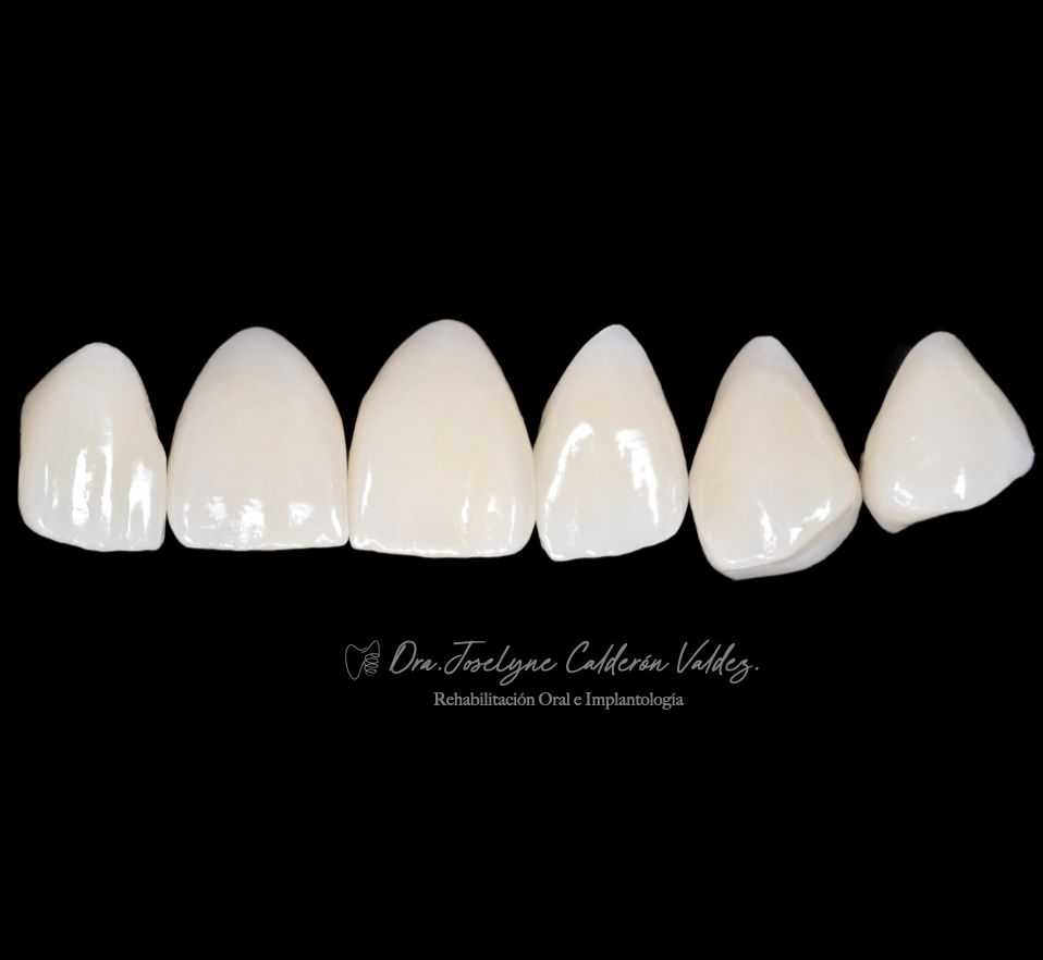 Joselyne Calderón Valdez-7