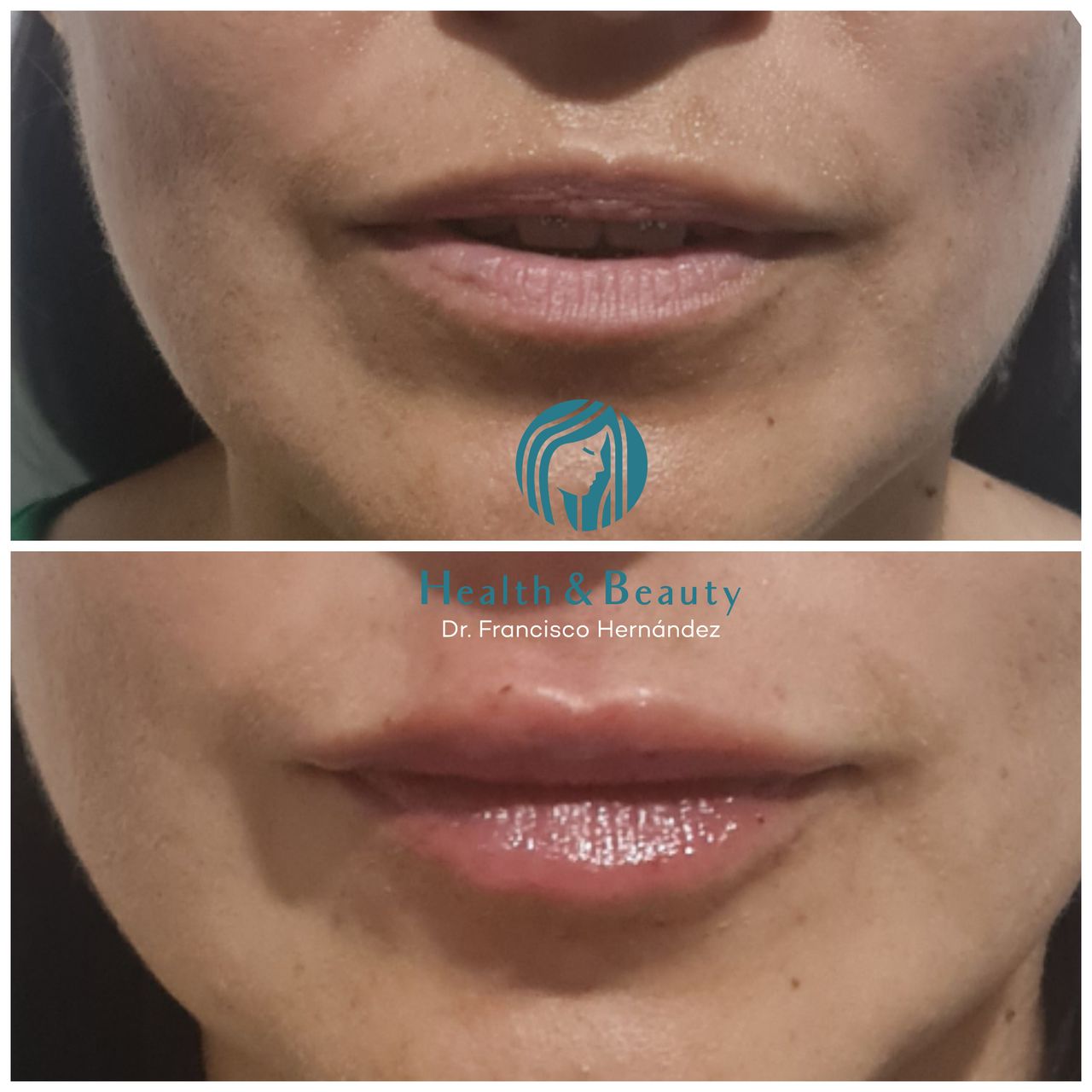 Francisco Hernández Gómez Crespo-193