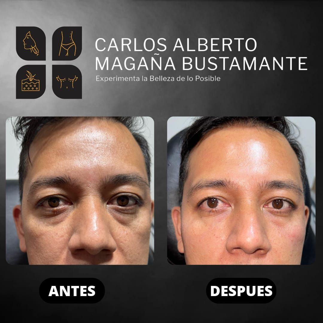 Carlos Alberto Magaña Bustamante-1