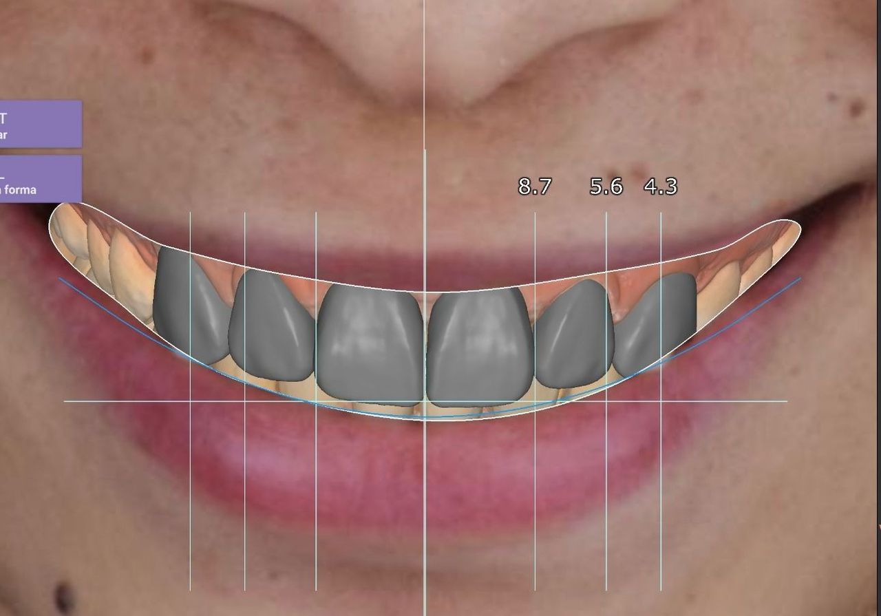 Fredy Alejandro Roblero Gónzalez-34