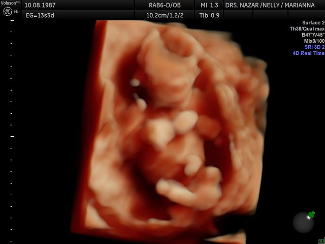 Miguel Angel González Nazar-16