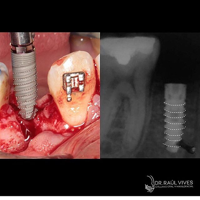 Raúl José Vives Serrano-7