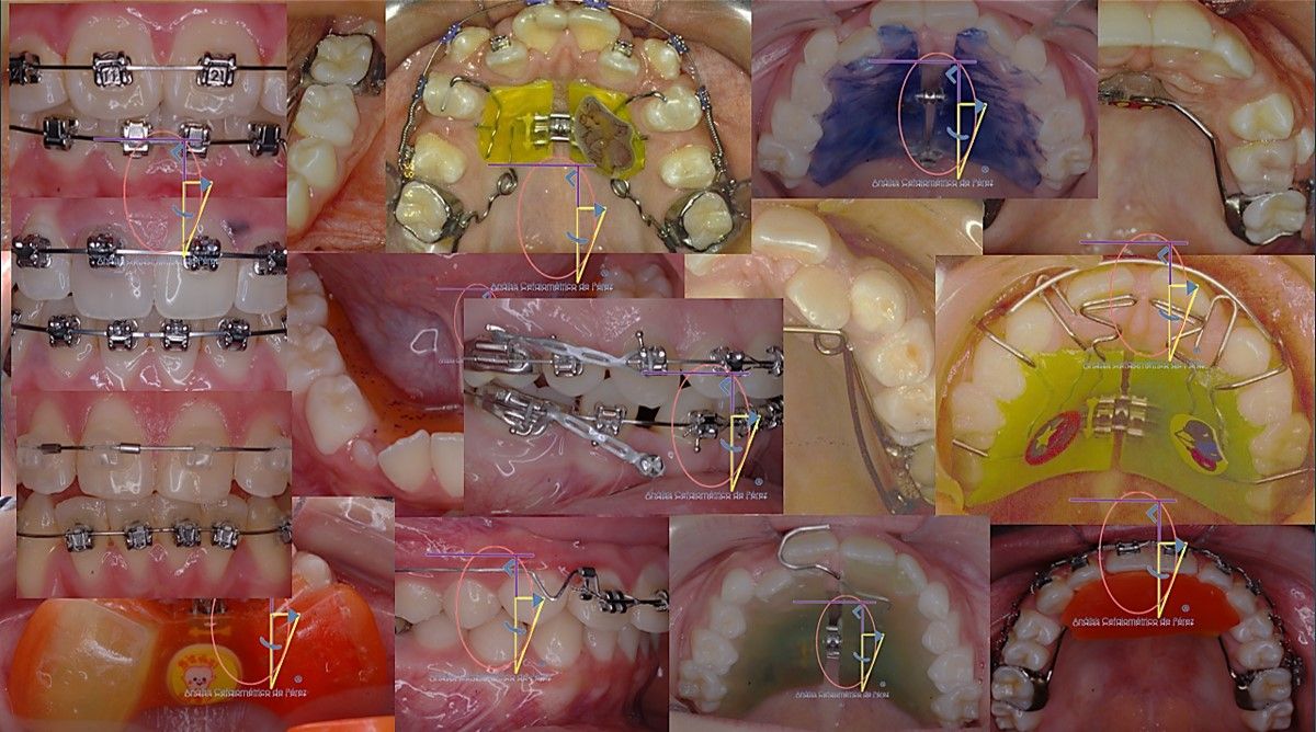 César Augusto Pérez Córdova-48