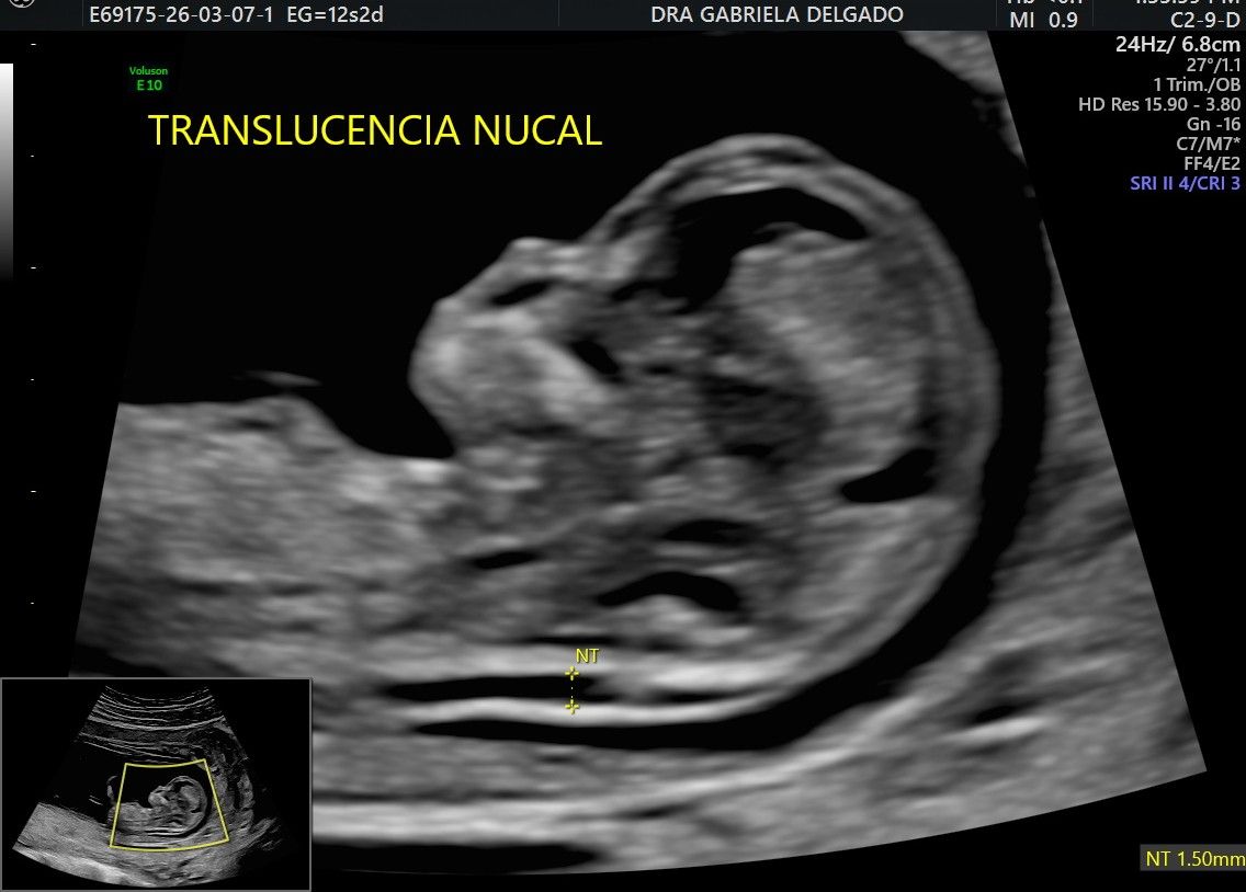 Gabriela Delgado Serrano-8