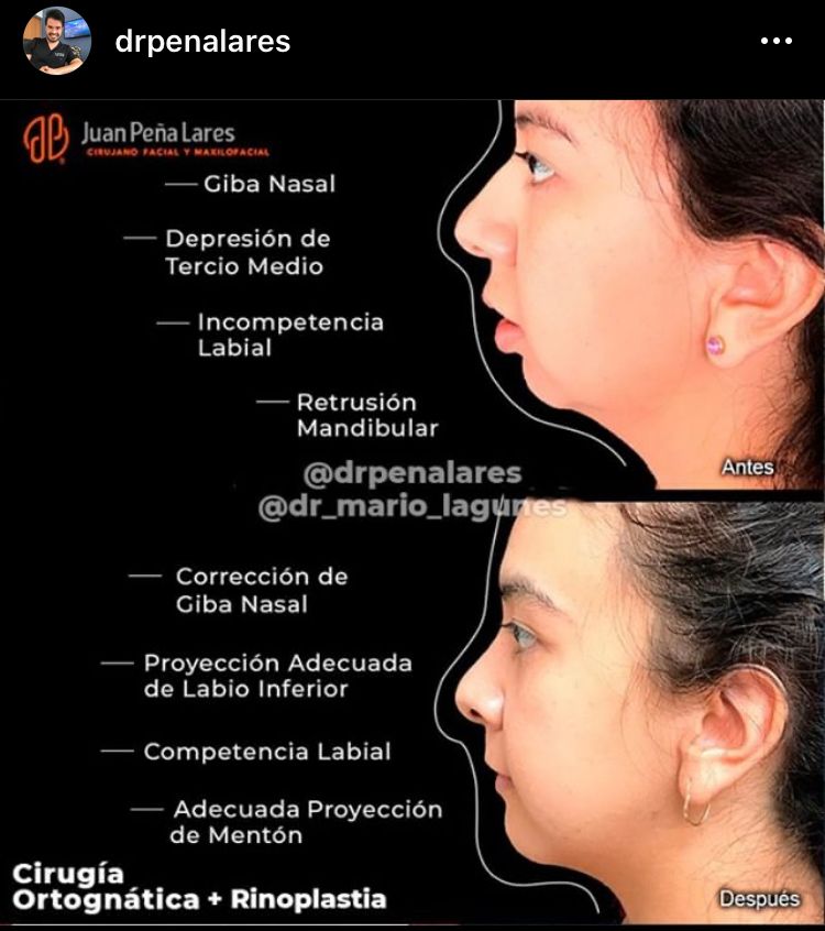 Juan Peña Lares-44