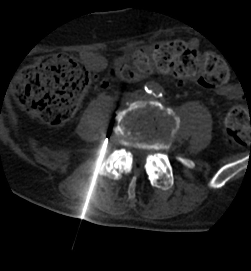 Luis Alonzo Briseño Salas-4