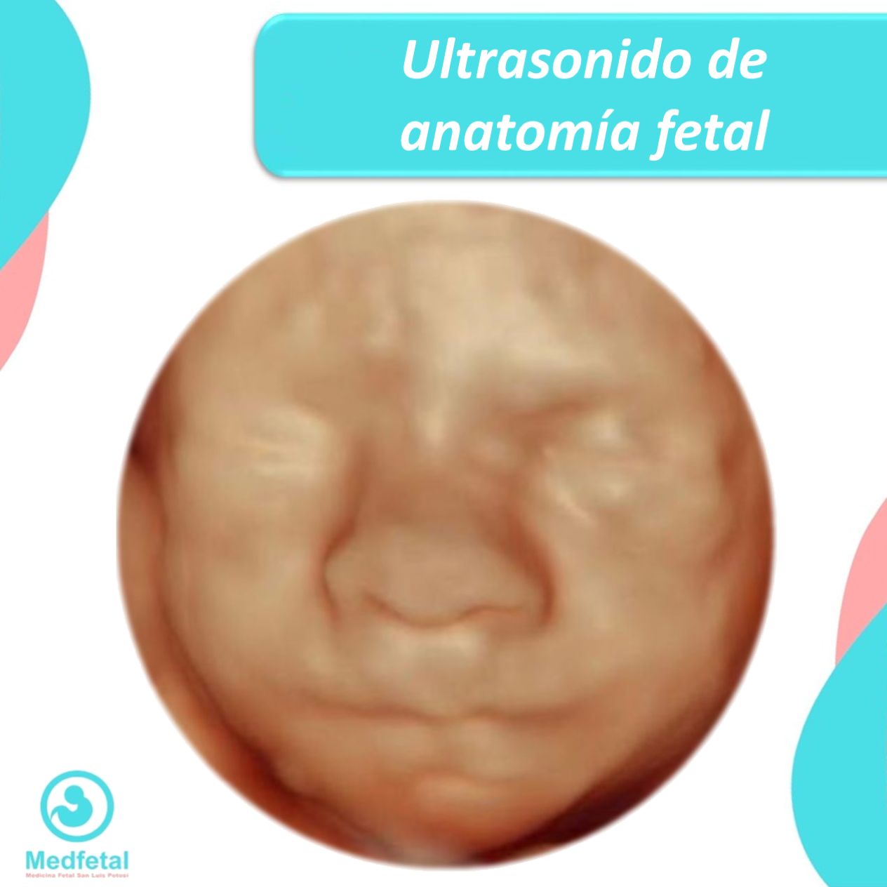 Manuel Ulises Reyes Hernández-9