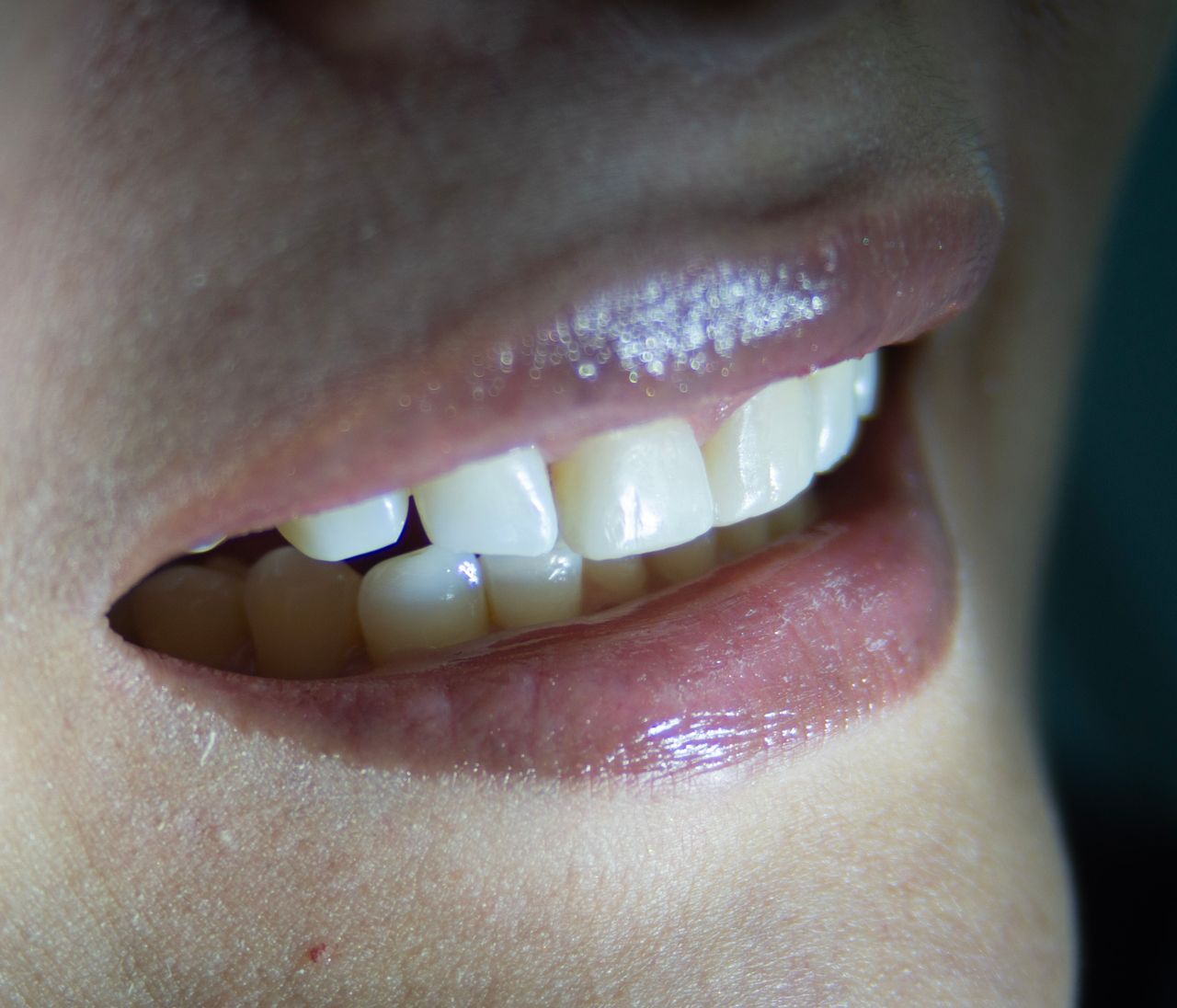 Ilse Valeria Osuna Rodríguez-11