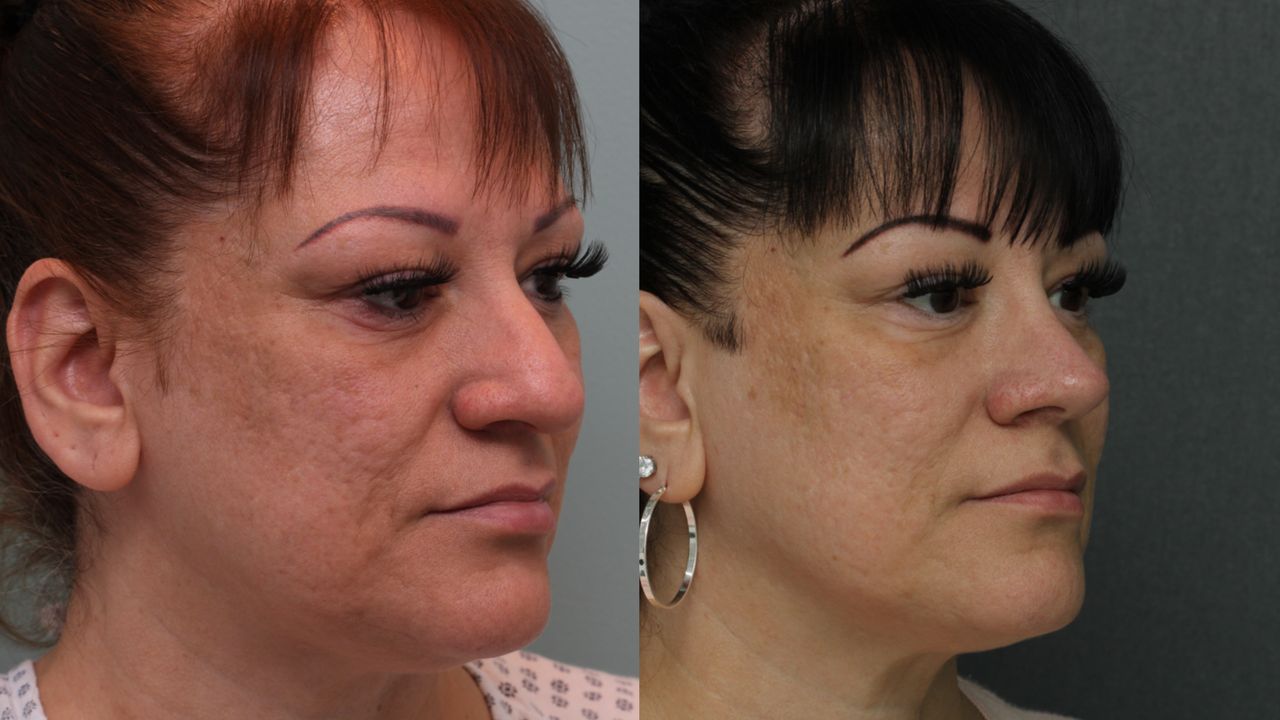 Angel Castro Urquizo-38