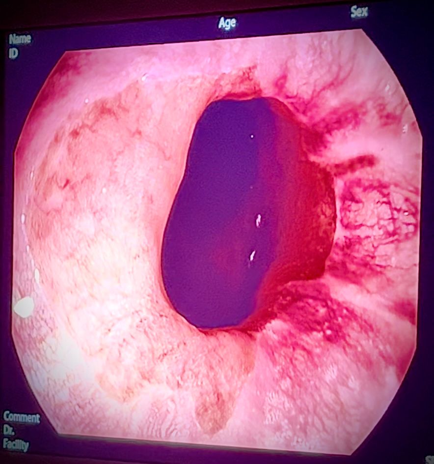 Rogelio Hernández García-71