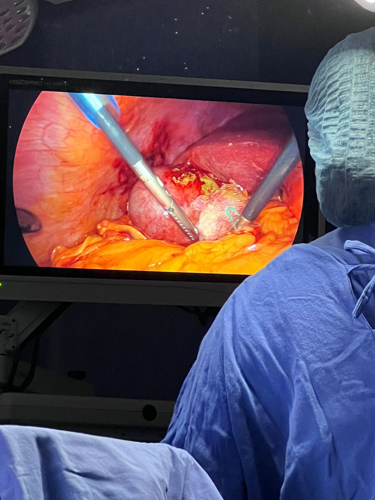 Juan Manuel Tierrafria Valle-4