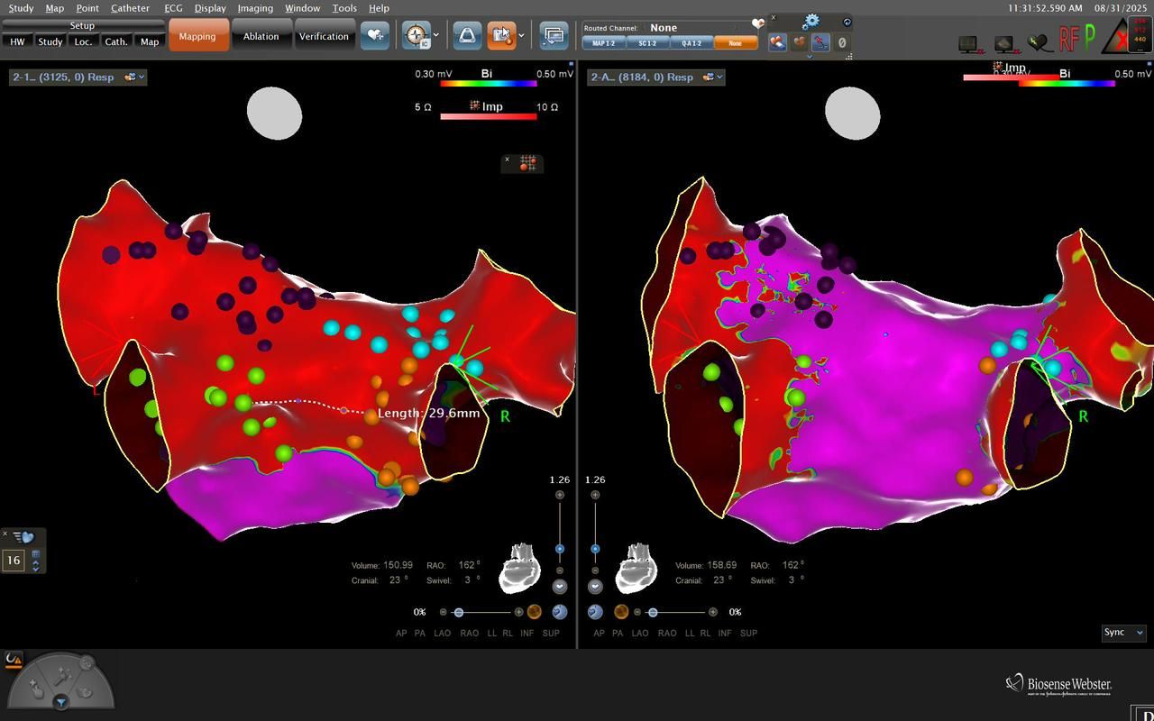 Elias Andrade Cuellar-9