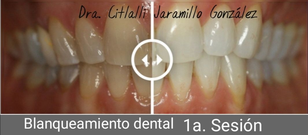 Citlalli Jaramillo González-3