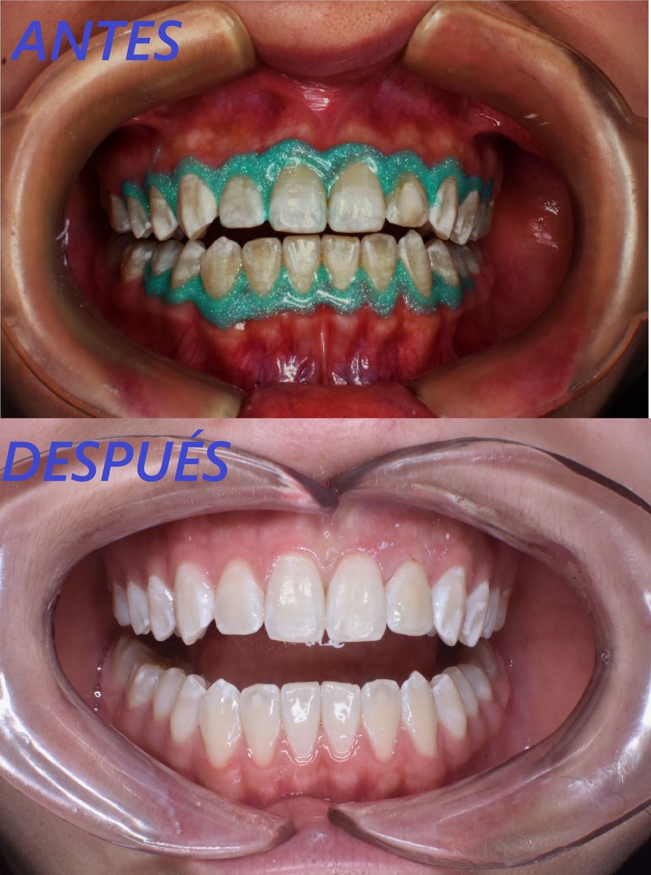 Ricardo Ivan Martínez García-1