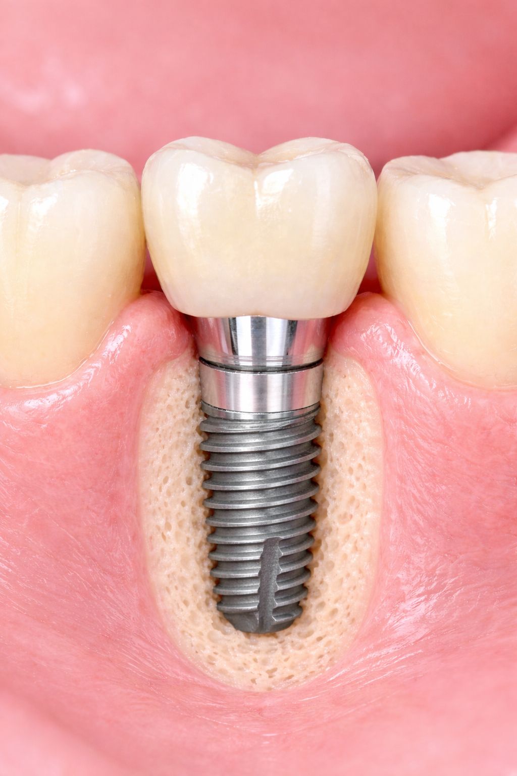 José  Luis Tapia Ibarra-0