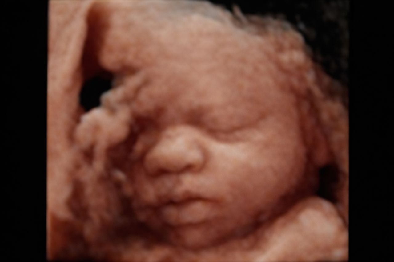 Miguel Alejandro Huerta Trujillo-8