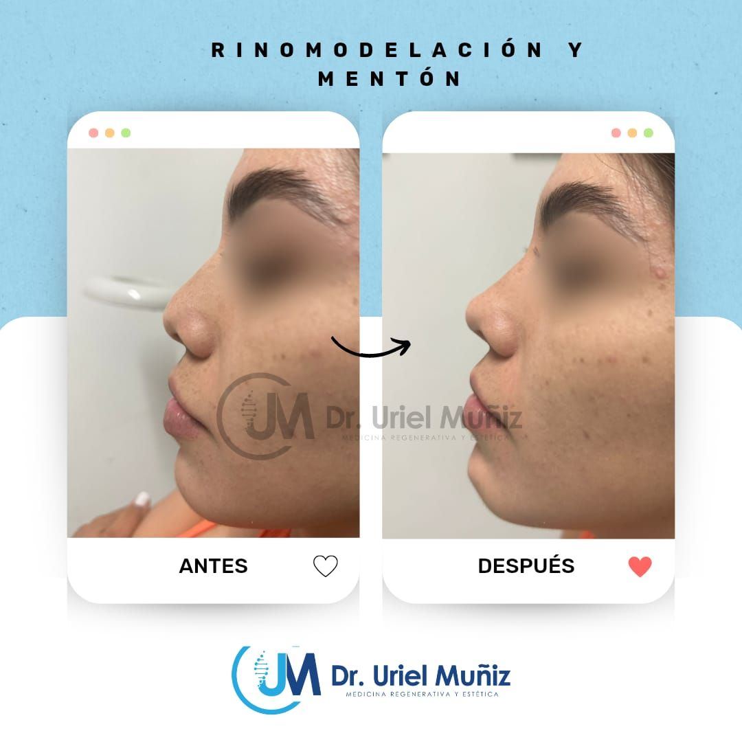 Teófilo Uriel Muñiz Chávez-22