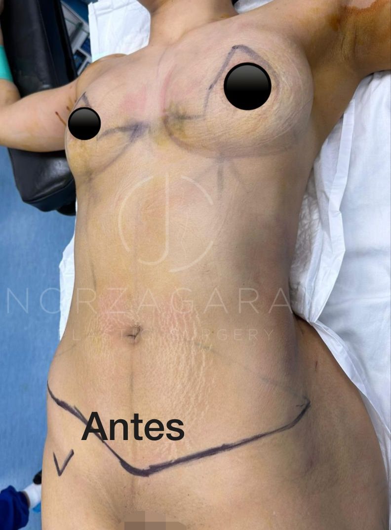 Juan Carlos Norzagaray-25