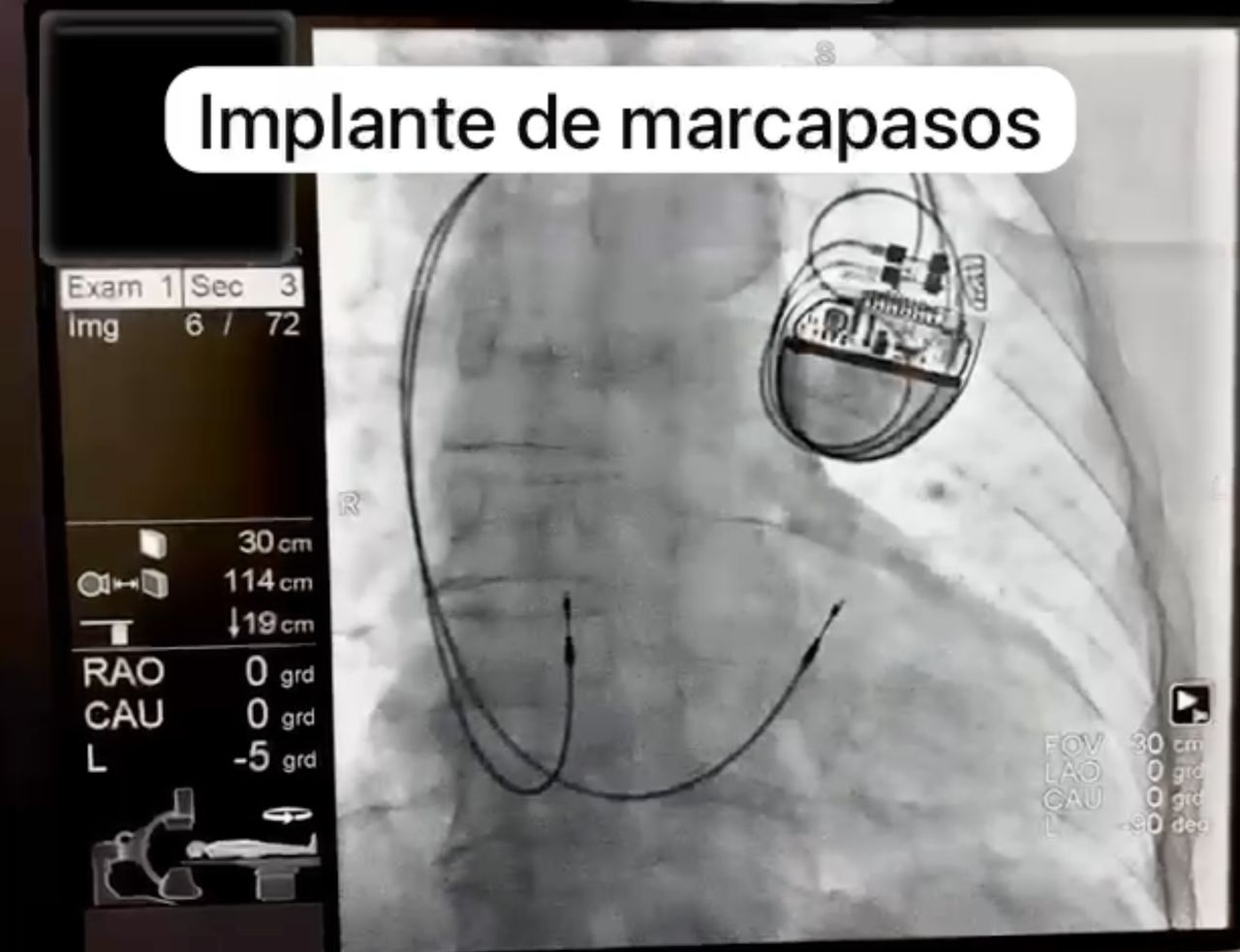 Mario Humberto Lozano Quintas-13