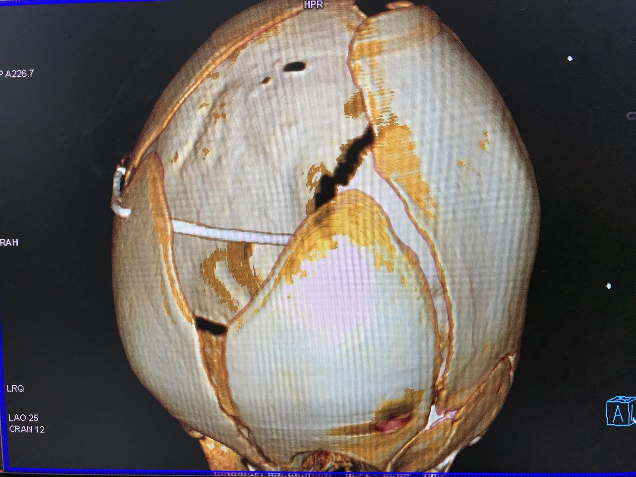 Rafael Maciel Morfin-42