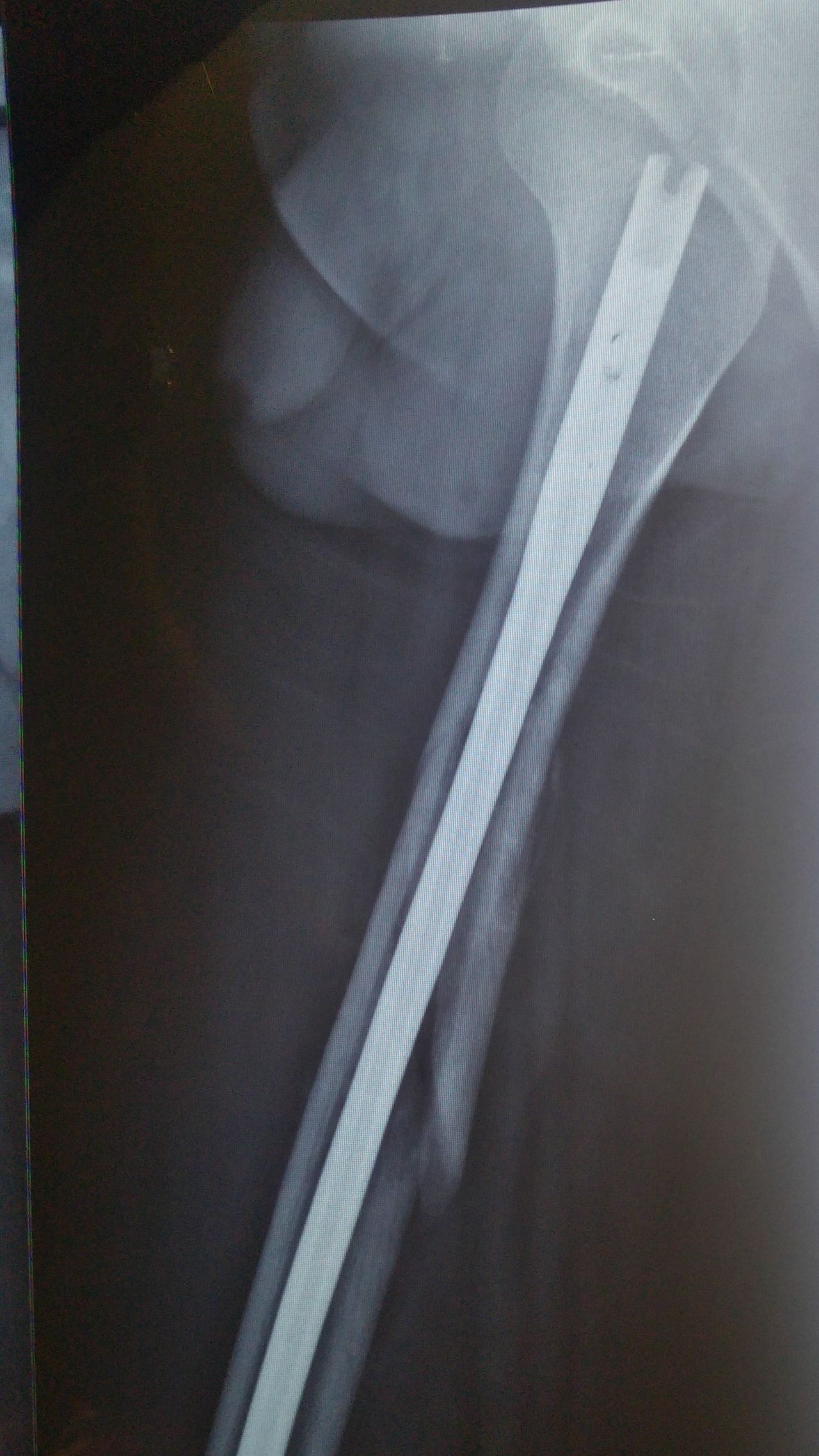 Rafael Antonio Ricárdez Balcázar-2