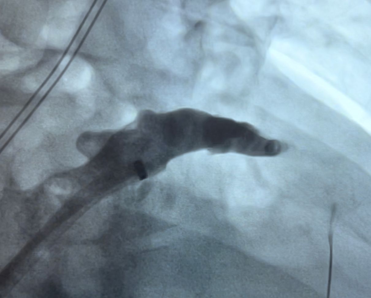 Abdón Ávila Chávez-9