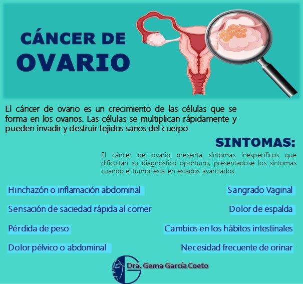 Gema García Coeto-11