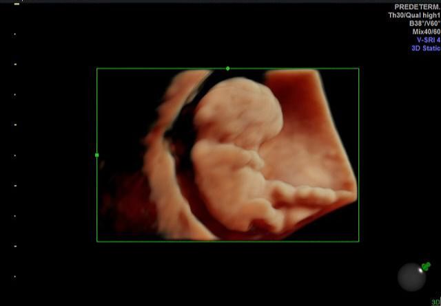 Graciela Elizabeth De La Torre Alvarez-33