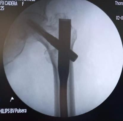 Juan Carlos Tellez Avila-8