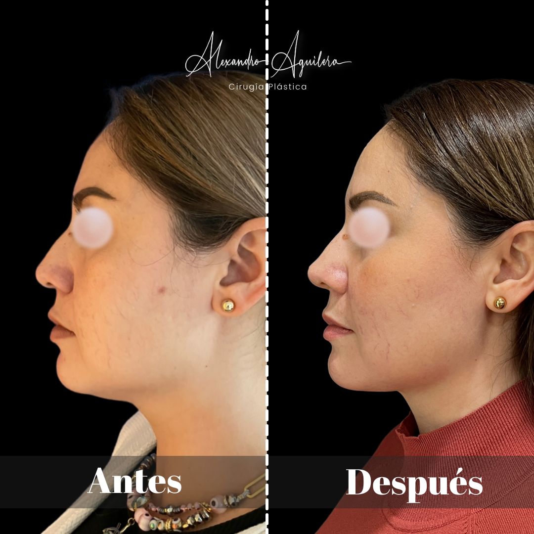 Alexandro Aguilera Salgado-27