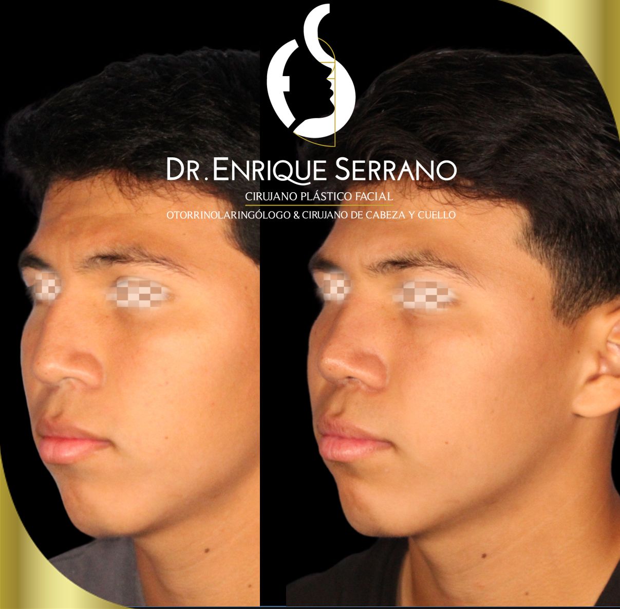 Enrique Serrano Cruz-13