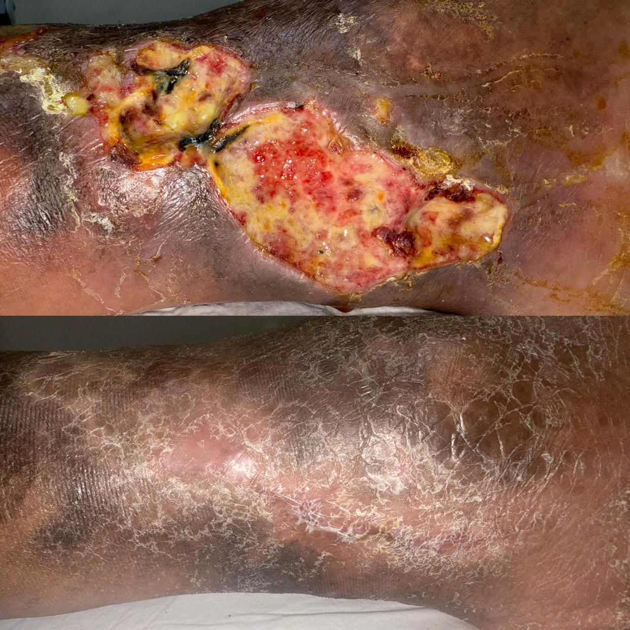 Jhonatan López González-76