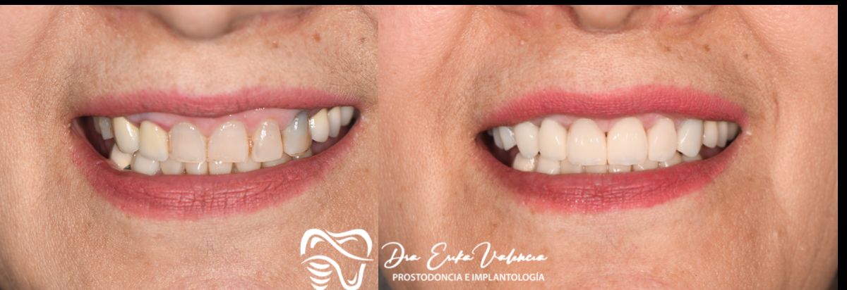 Erika Stephany Valencia Delgadillo-2