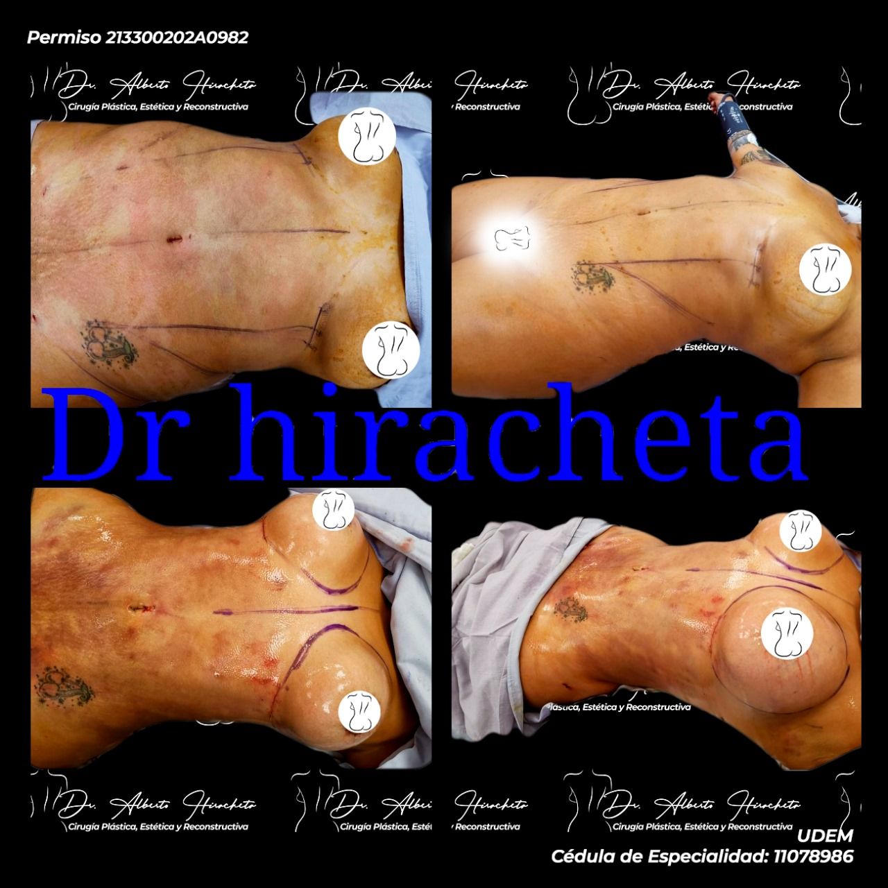Alberto Hiracheta Torres-2