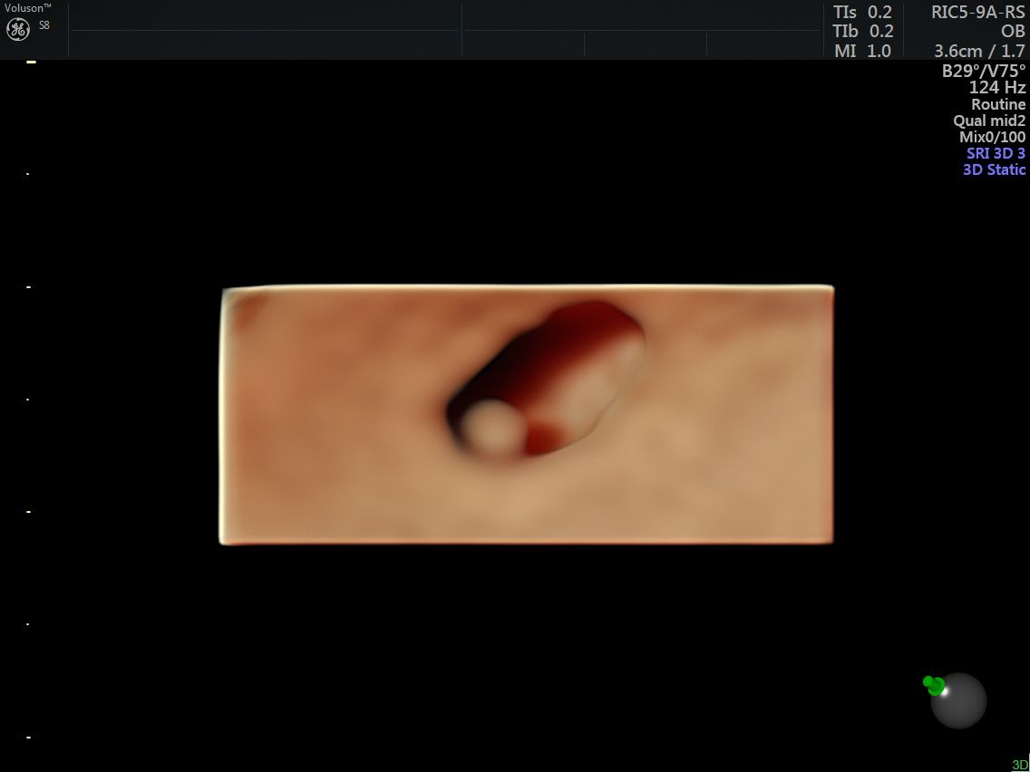 Griselda Reyes Torres-72