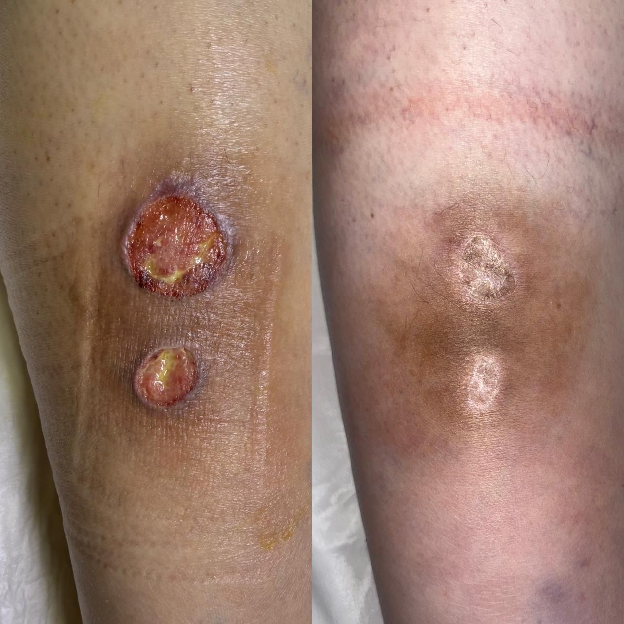 Jhonatan López González-68