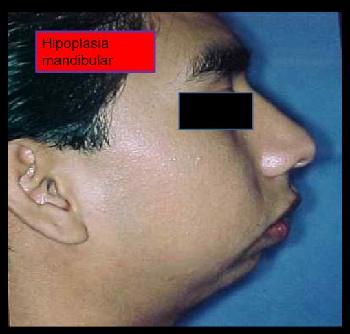 Diana Araceli Dávila Hernández-35