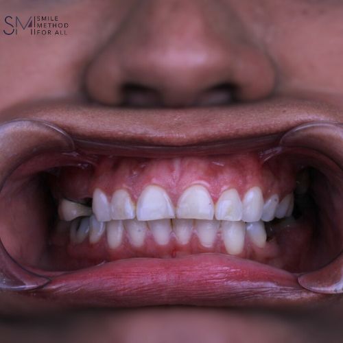 Arturo Mendez Valencia-37