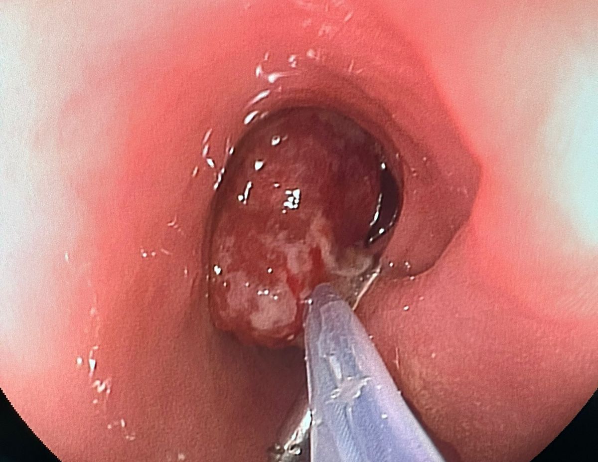 Byron Campoverde Arevalo-0