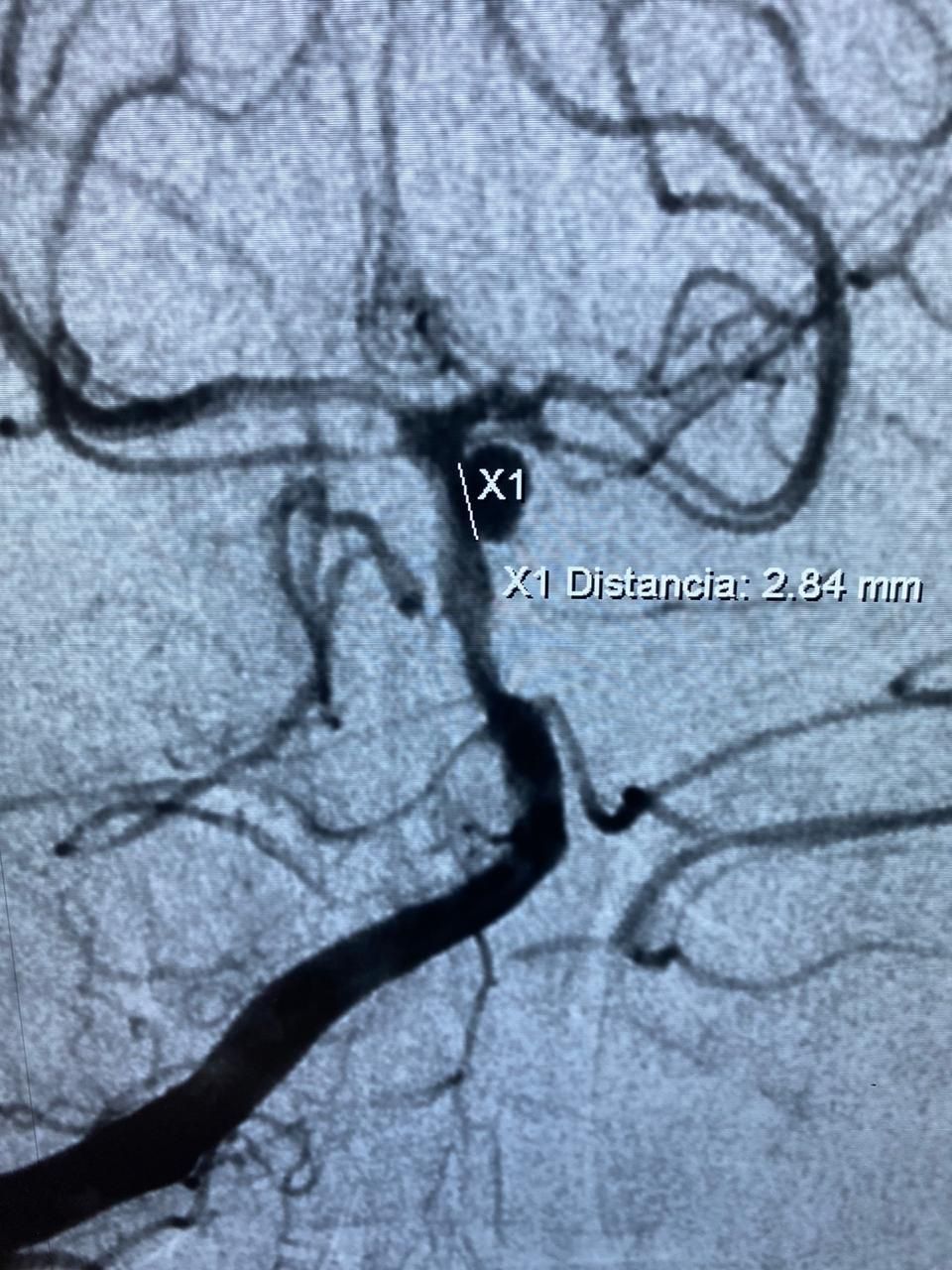 Edgar Fernando Acosta Gomez-7