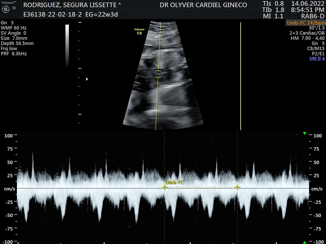 Olyver Cardiel Rivera-12