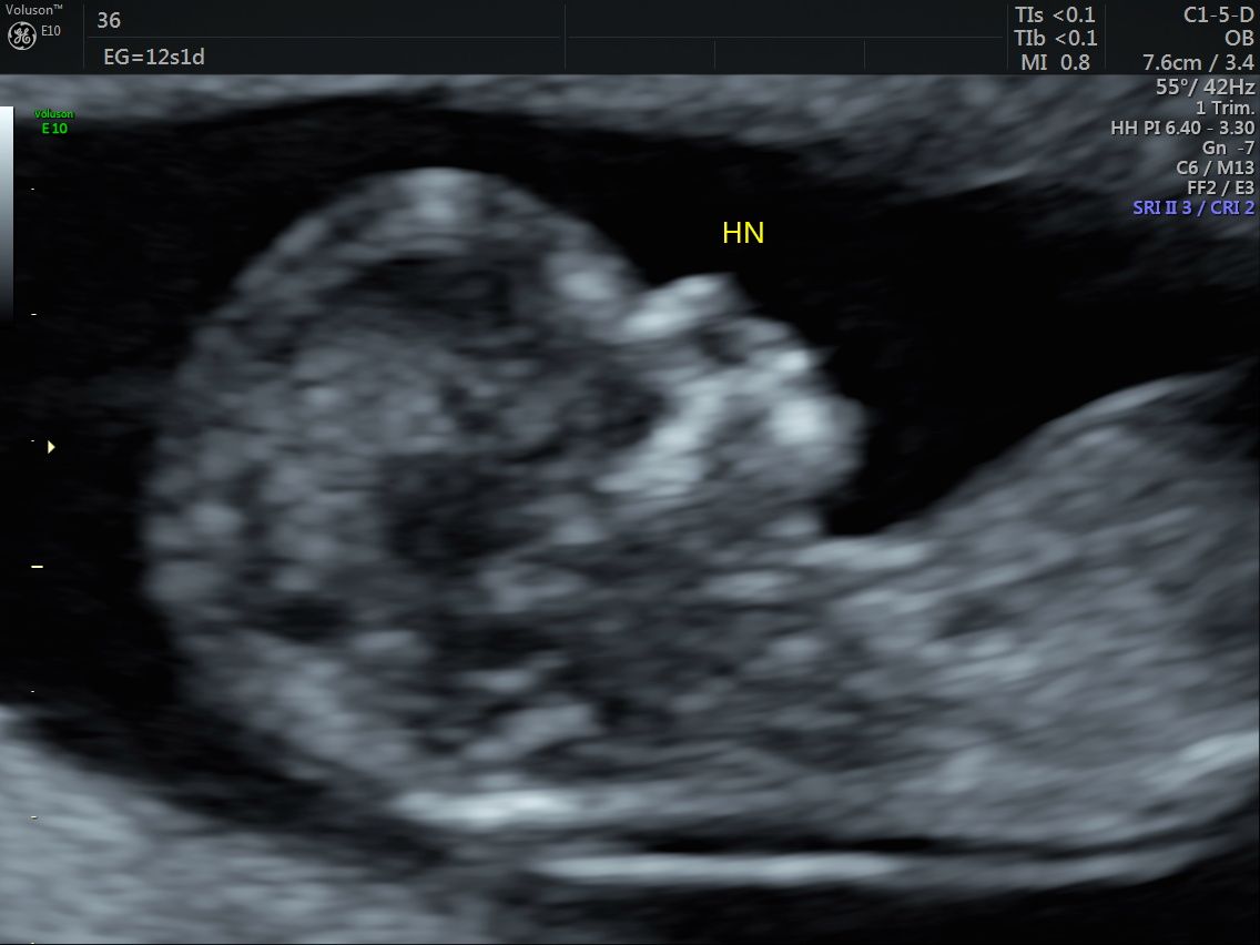 Gabriela Delgado Serrano-6