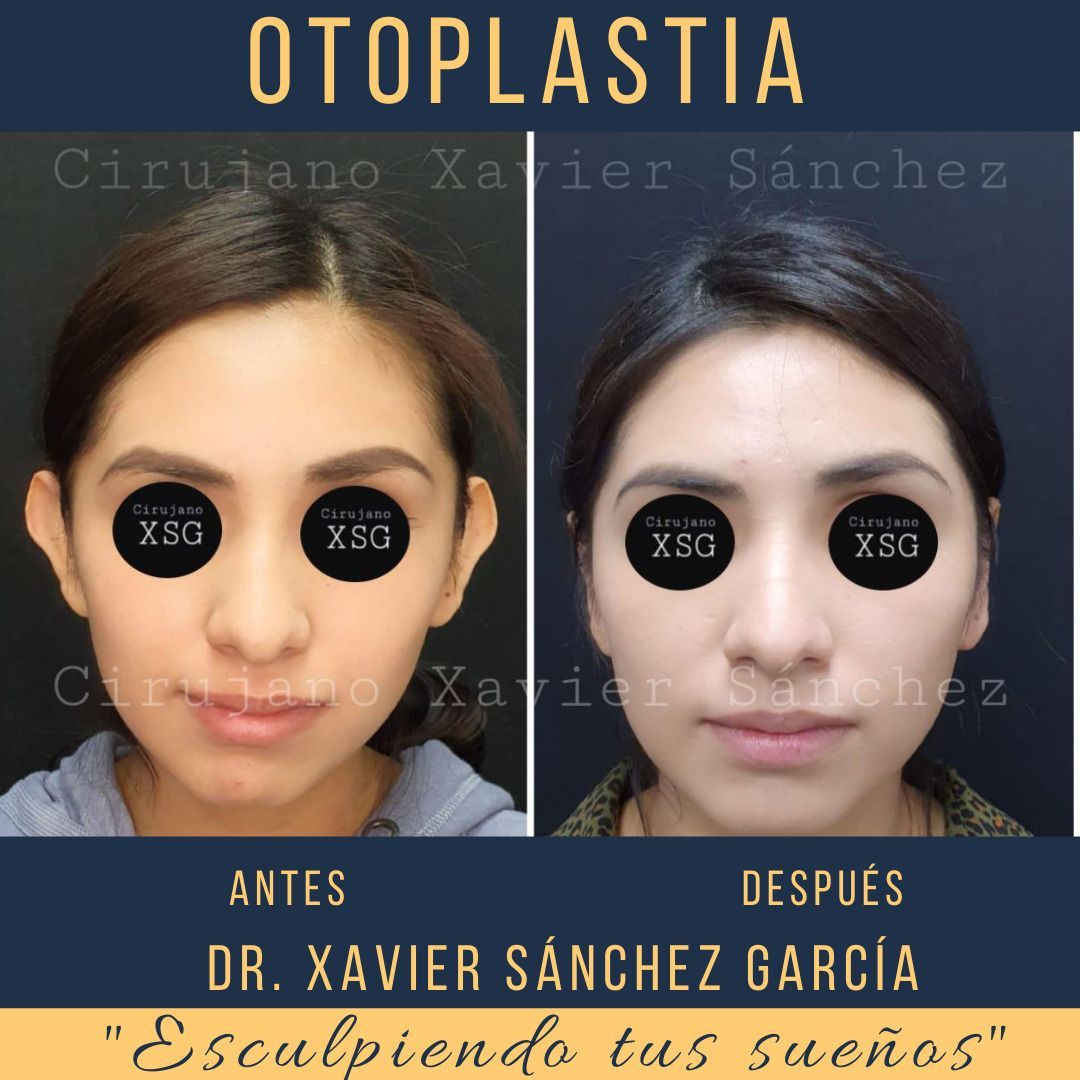 Xavier Sánchez García-27