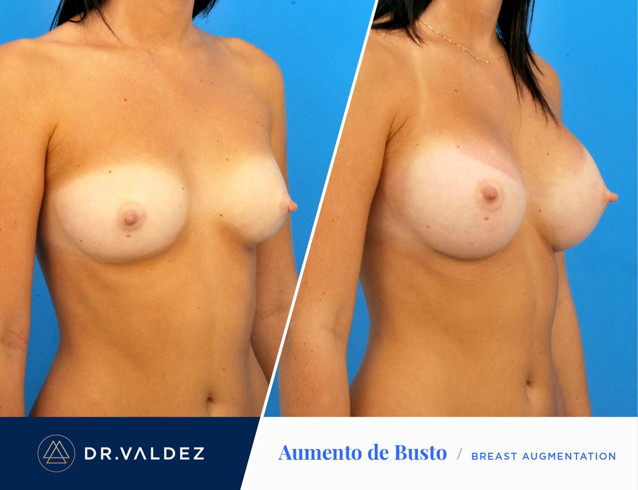 Pedro Arturo Valdez Gomez-23