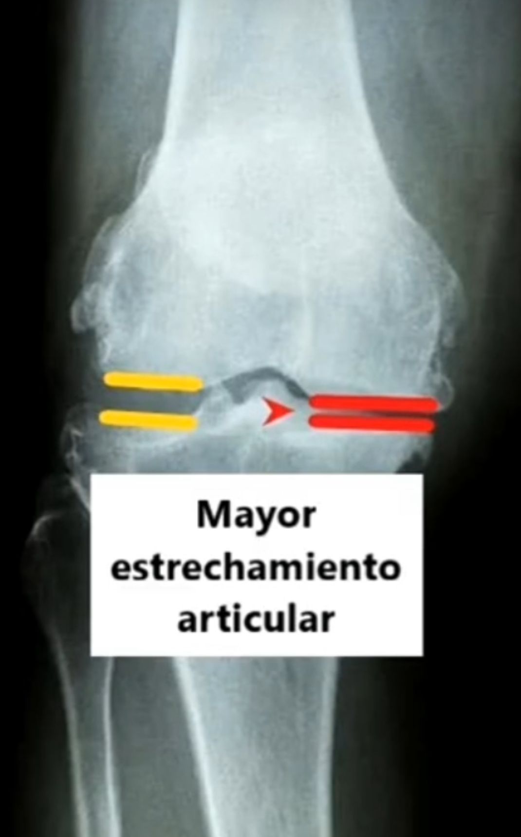 Sergio Eduardo Suarez De La Cruz-4